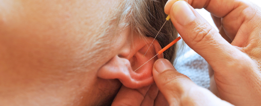 Professionelles Akupunktur Zubeh&ouml;r f&uuml;r Therapien in Praxis und medizinischen Einrichtungen