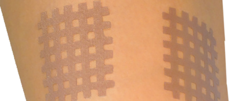 Netzartiges Gittertape zur Therapieunterst&uuml;tzung f&uuml;r verschiedene K&ouml;rperbereiche anwenden
