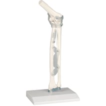 Erler-Zimmer Ellenbogengelenk mit Bänder