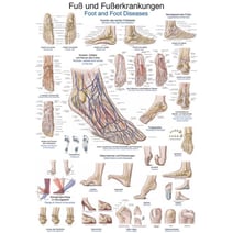 Lehrtafel - Fuß und Fußerkrankungen
