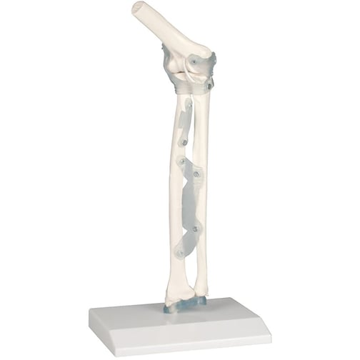 Erler-Zimmer Ellenbogengelenk mit Bänder