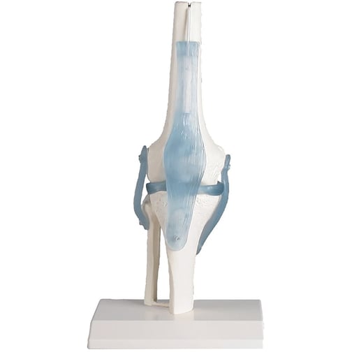 Erler-Zimmer Kniegelenk mit Bändern