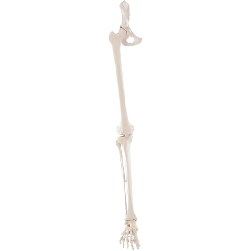 Erler-Zimmer Beinskelett