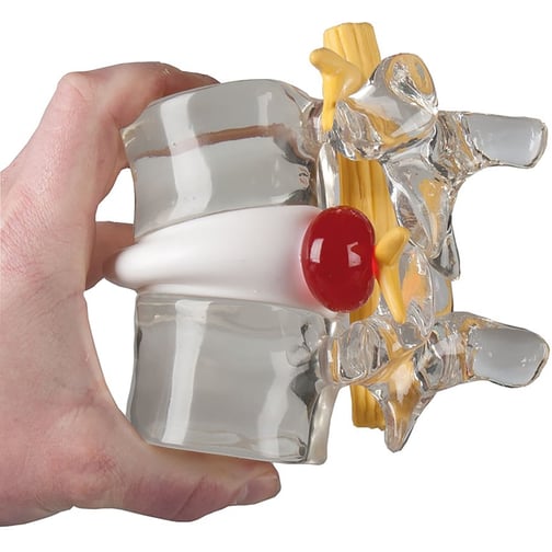 Erler-Zimmer Bandscheiben-Vorfall-Simulator