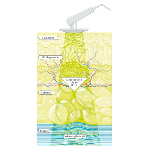 PHYSIOMED® DEEP OSCILLATION® Personal Pro