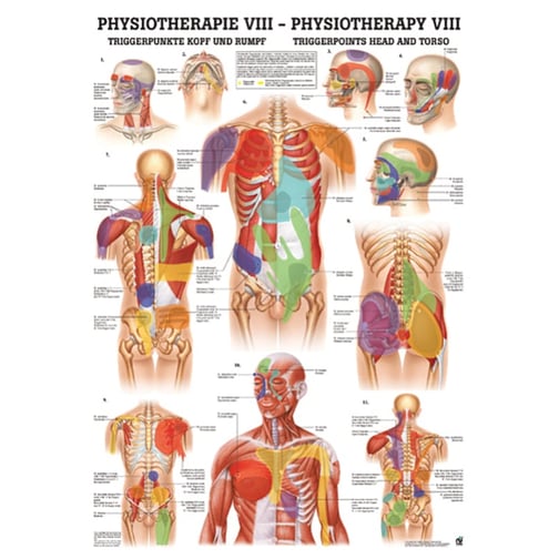Poster - Triggerpunkte Kopf und Rumpf