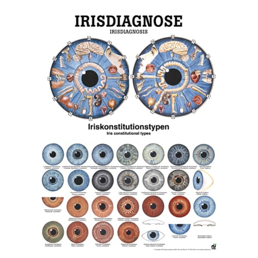 Poster - Irisdiagnose