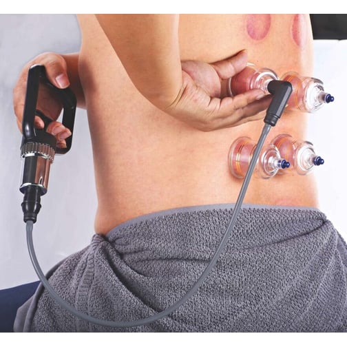 AcuTop® Schröpf Set