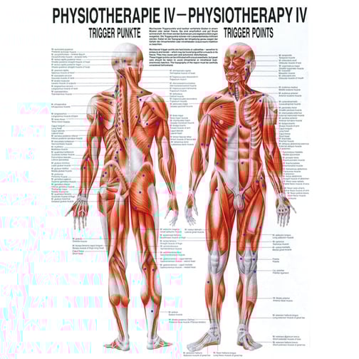 Poster - Triggerpunkte