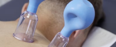 Schr&ouml;pfgl&auml;ser