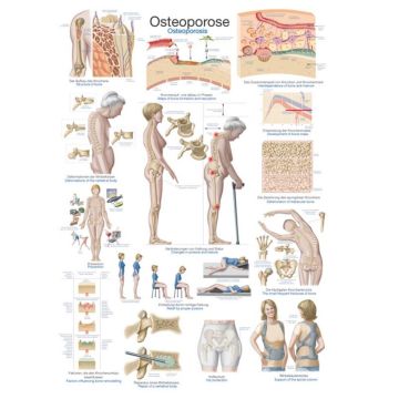 Lehrtafel - Osteoporose