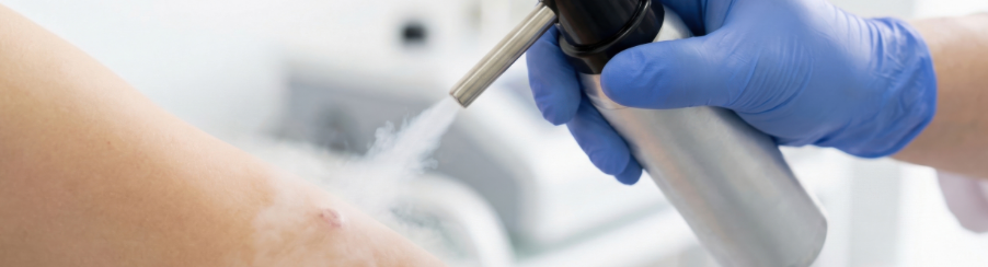 Eisspray für den professionellen Therapiebedarf und die Anwendung bei Sportverletzungen